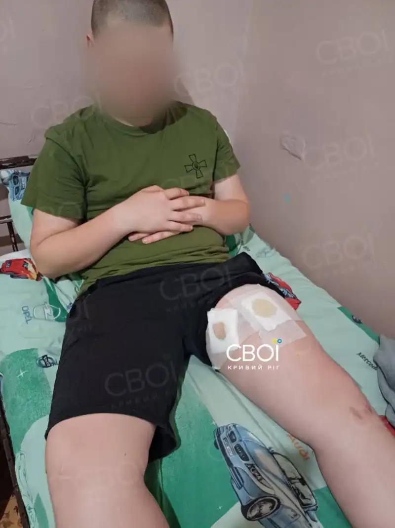 У Кривому Розі чоловік відкрив стрілянину з вікна – поранено 13-річного хлопчика У Кривому Розі чоловік відкрив стрілянину з вікна – поранено 13-річного хлопчика